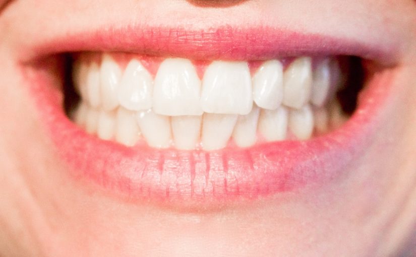 Aktualna technika wykorzystywana w salonach stomatologii estetycznej może sprawić, że odzyskamy prześliczny uśmiech.